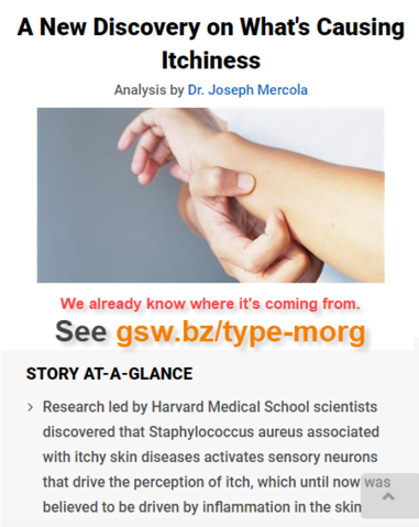 Itchiness, we already know where it's coming from.png